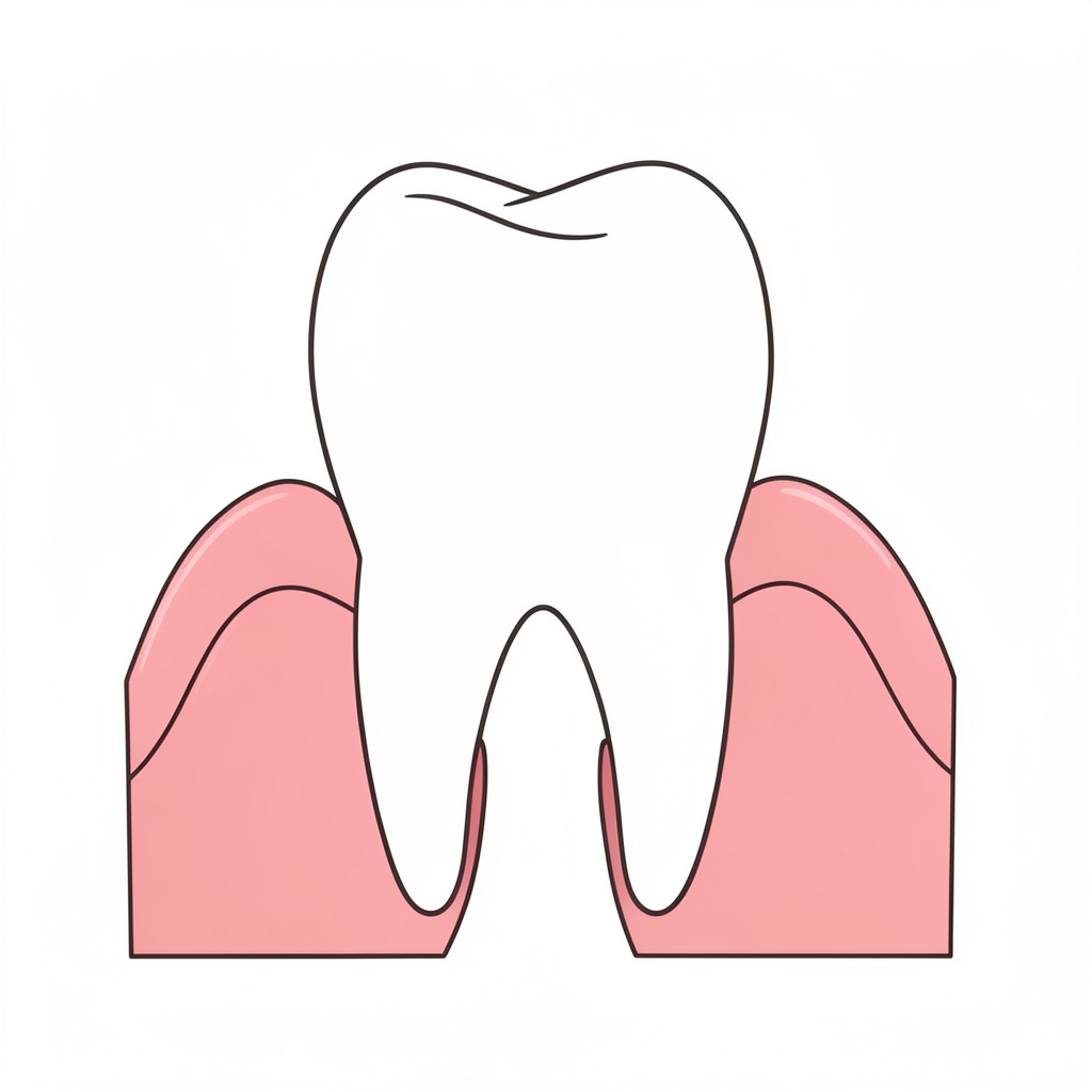 Diagram showing early periodontitis