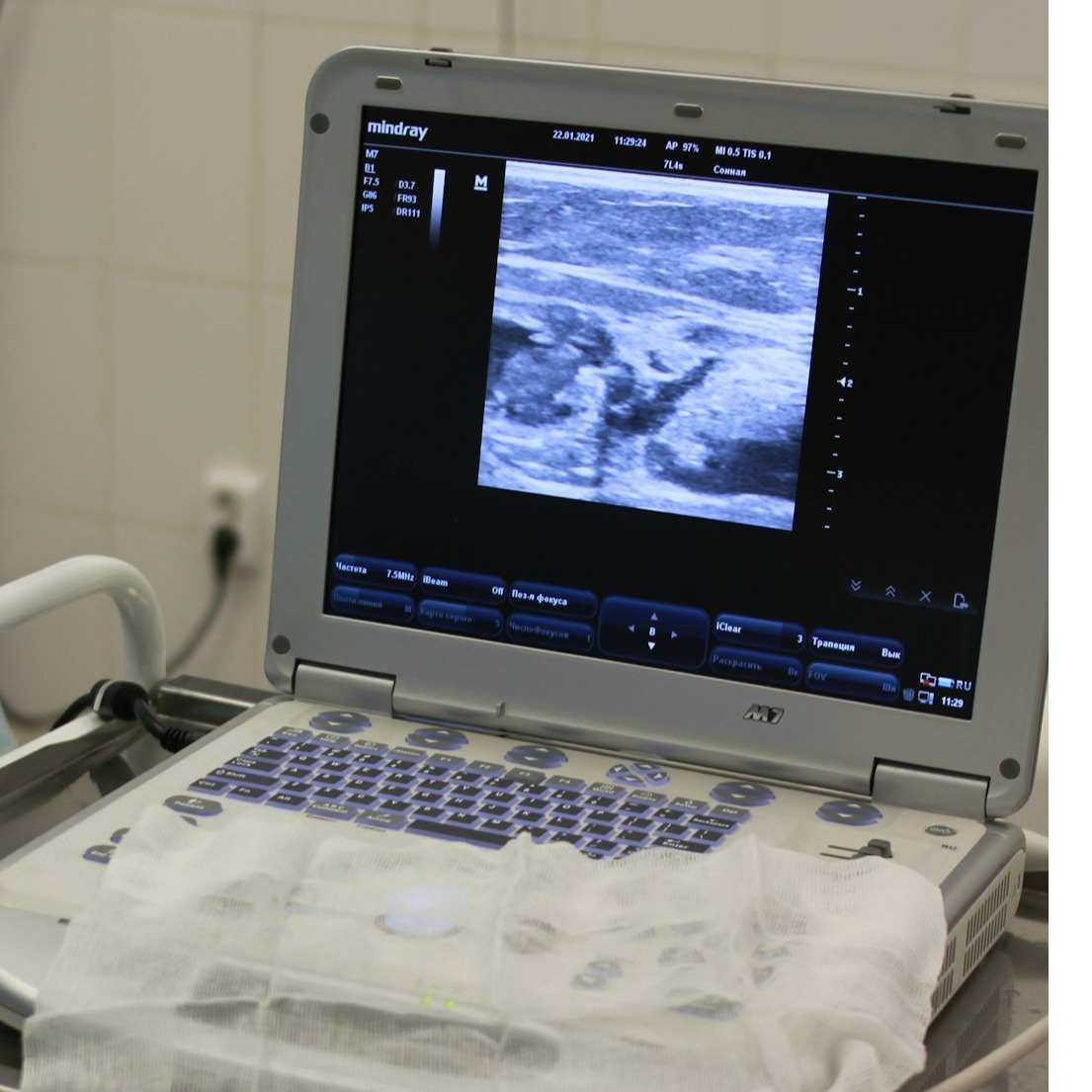 A high-resolution ultrasound image of a baby's face in the womb, conveying peace and innocence.