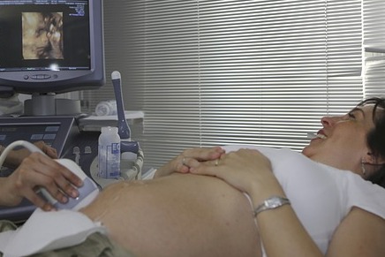 A split image, one side showing an abstract concept of pregnancy, the other side showing a clear ultrasound image, highlighting the difference in impact.