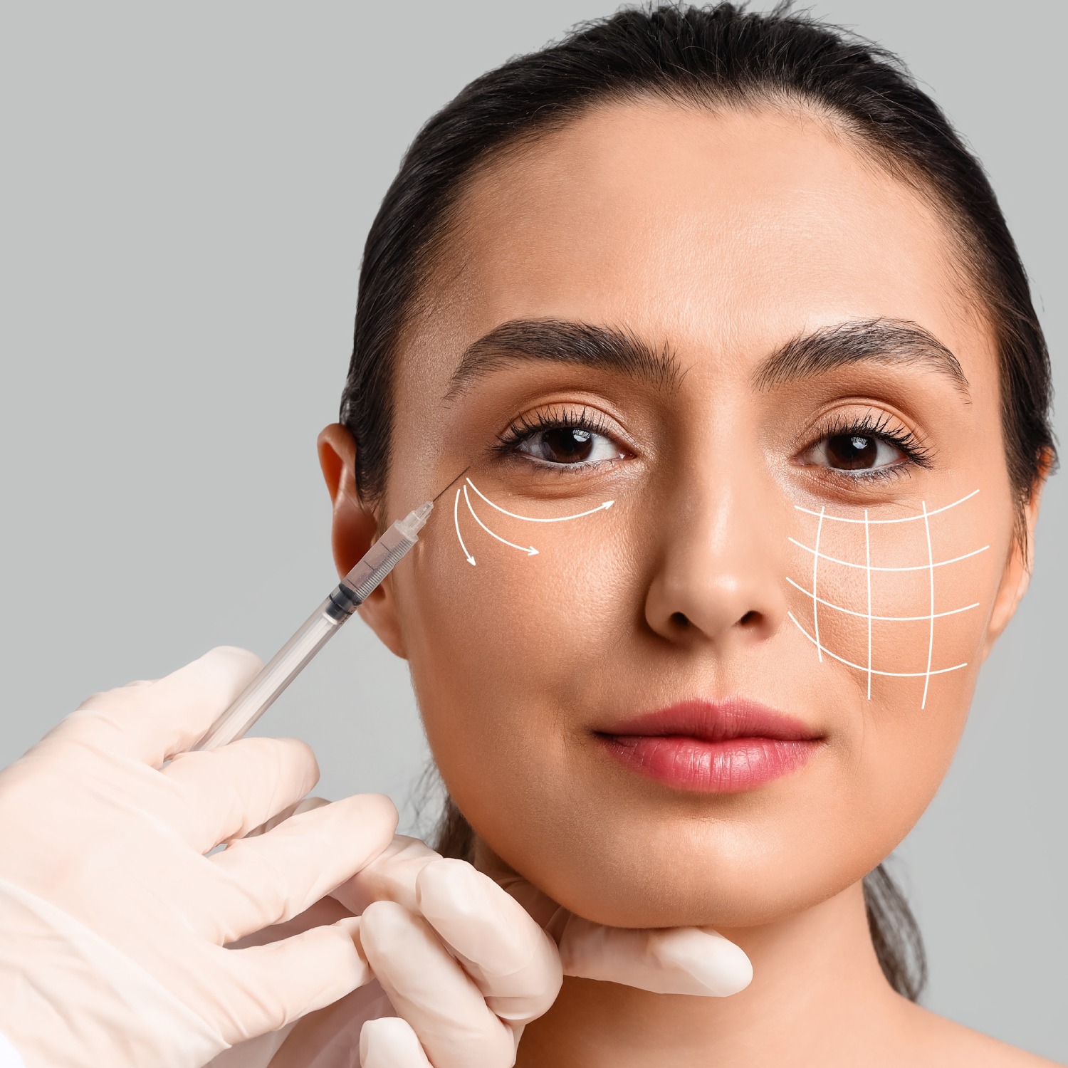 Advanced laser technology being used to rejuvenate skin, with a focus on the precision and effectiveness of the treatment.